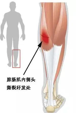 深靜脈血栓類(lèi)似病癥的認(rèn)識(shí)與區(qū)分